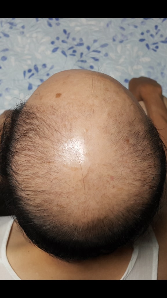 비교하시라고 8월20일사진올립니다.