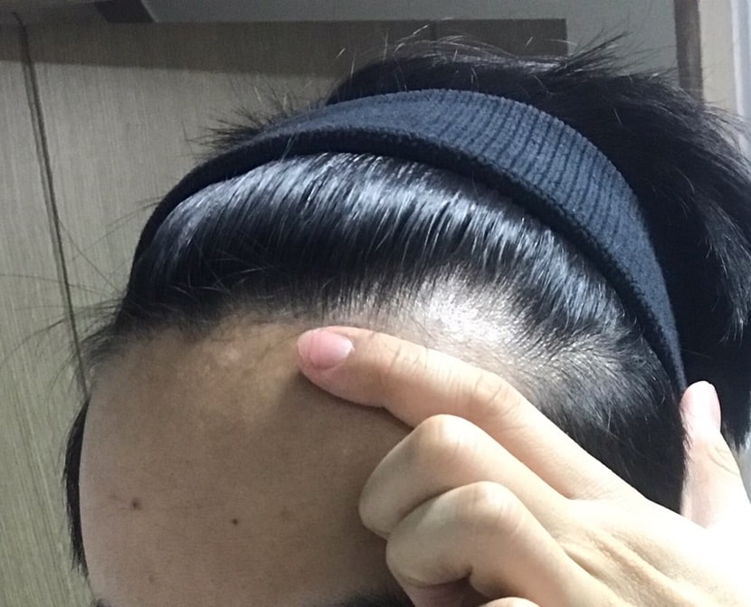 왼쪽