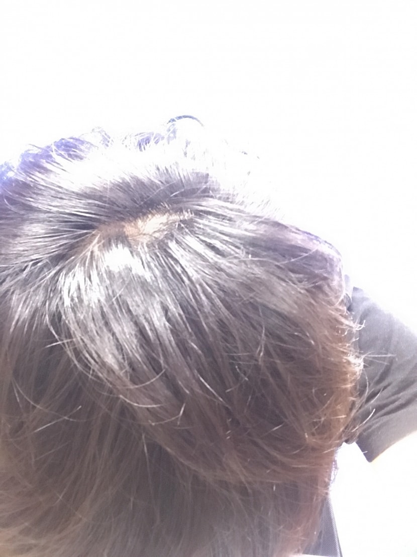 정수리