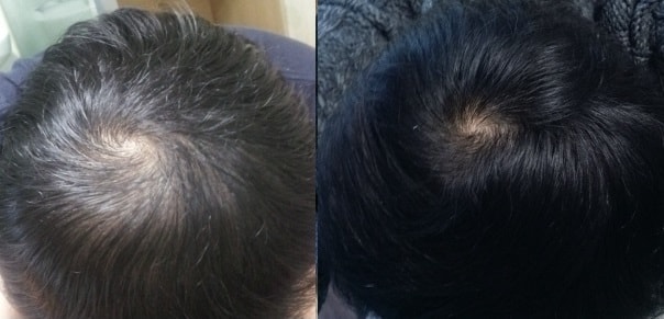 普罗佩西亚八个月后期