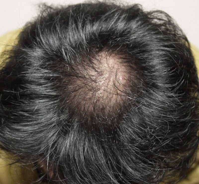 第4个月普罗斯卡