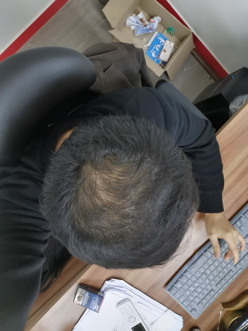 4개월 복용후