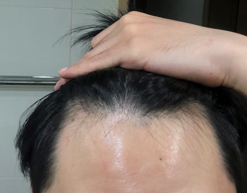 복용전