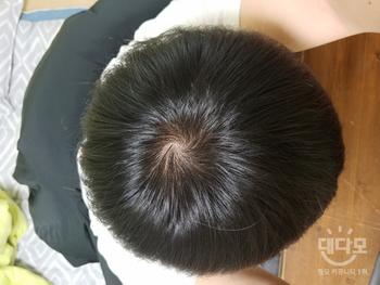 복용전 작년 3월