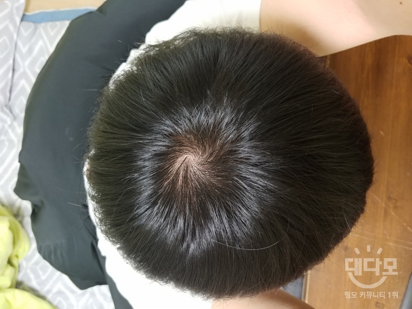복용전 작년 3월
