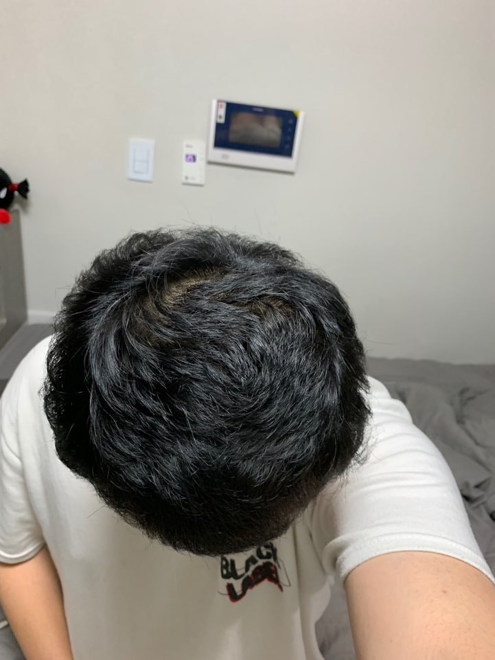 6개월차