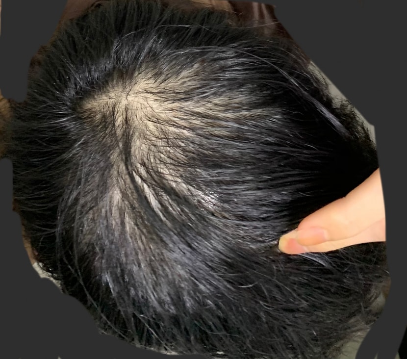 오늘 미녹뿌린 직후입니다. 