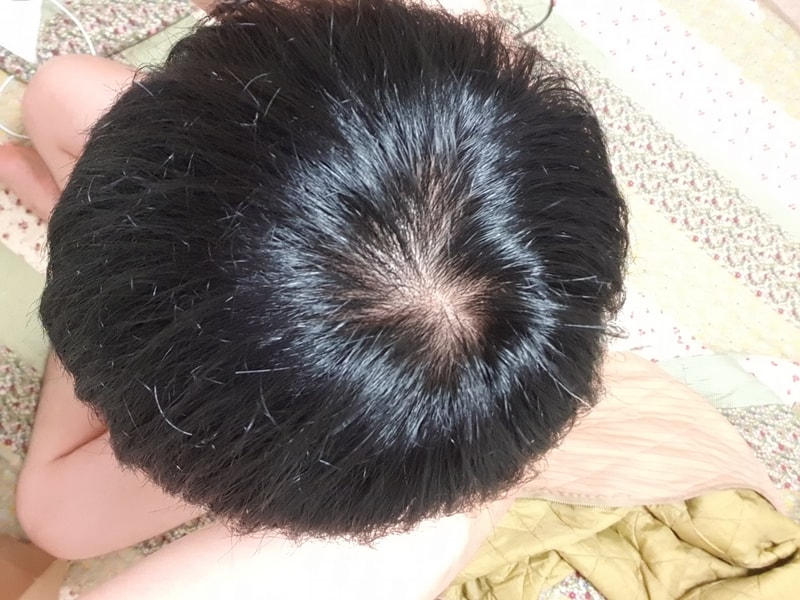 プペ 1ヶ月目体験談