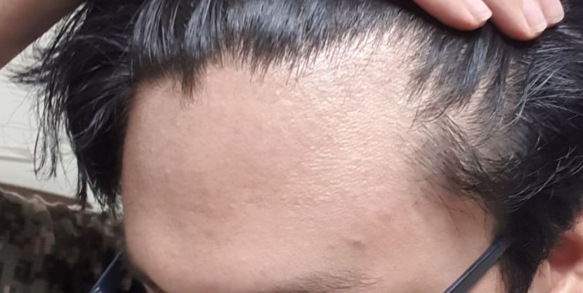 현재