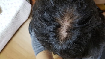 복용4일차입니다.