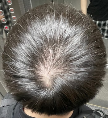 조명이 강한 장소에서 찍으니깐 두피가 더 보이네요..