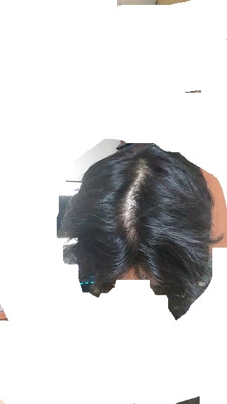 프페복용전 약 6개월전