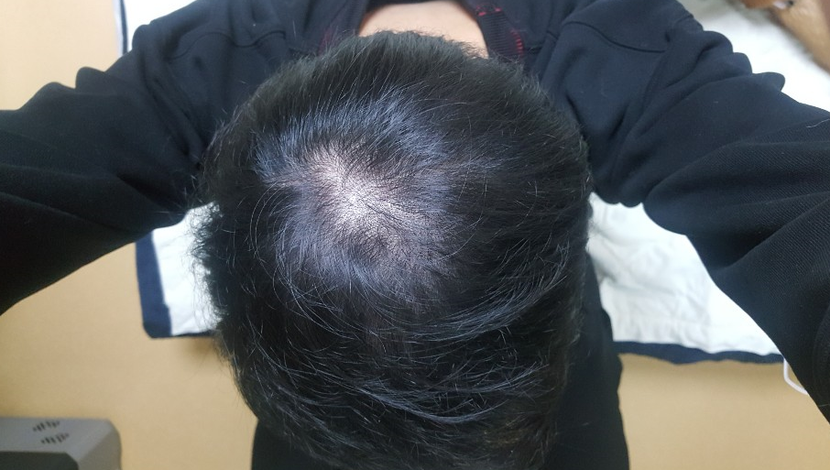 3개월된 오늘 아침