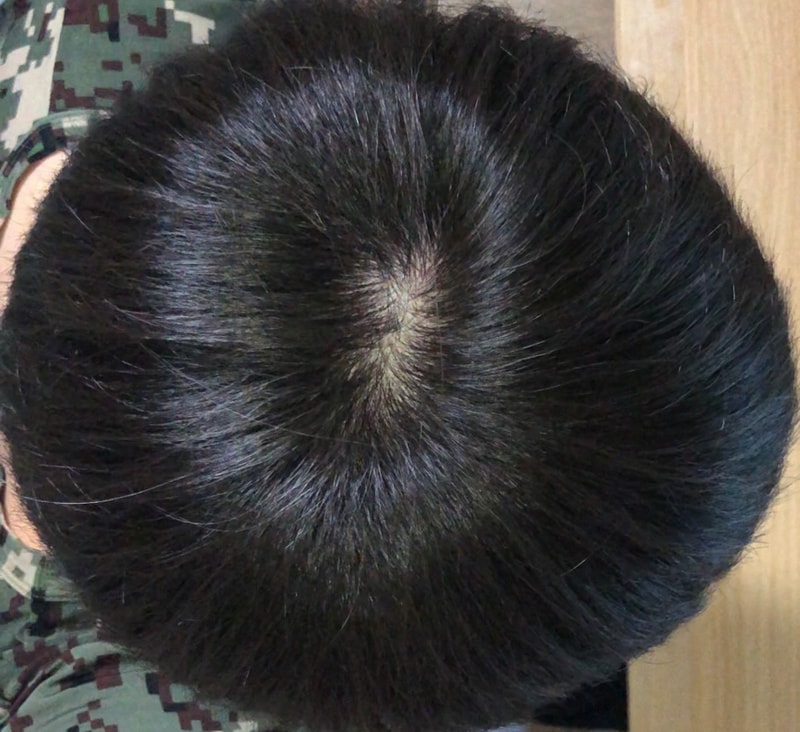 Professionalsia sees hope in month four