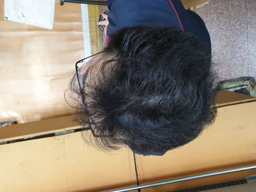 5개월 복용