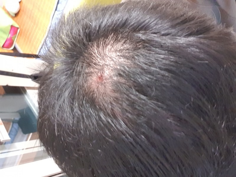 久しぶりにまた来る6ヶ月の薬の処方体験談