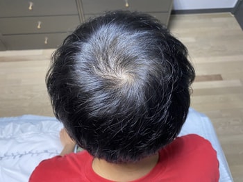 이건 지난주 토요일. 7월 사진과 같은 조건에서 찍었습니다!
