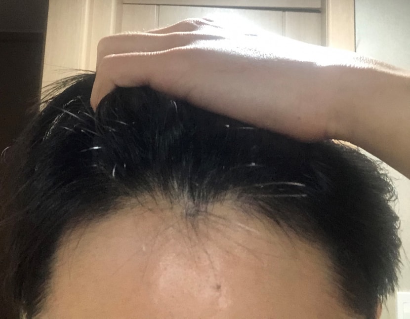 복용 5개월차