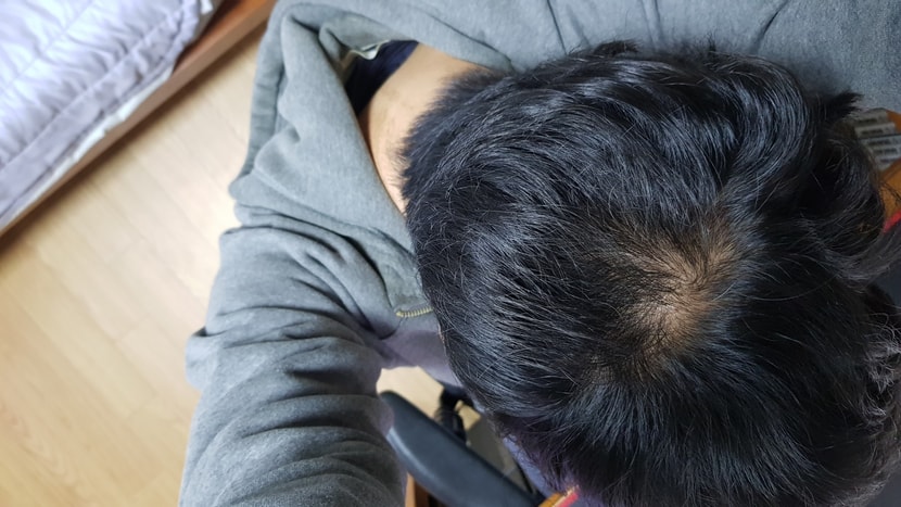 복용1일차이고