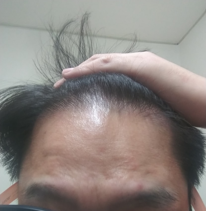 1월 쉐딩 앞