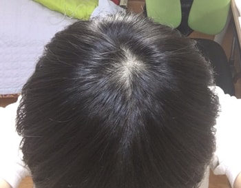 이게 먹기 1일차인데 사진을 잘 못찍었었네요.