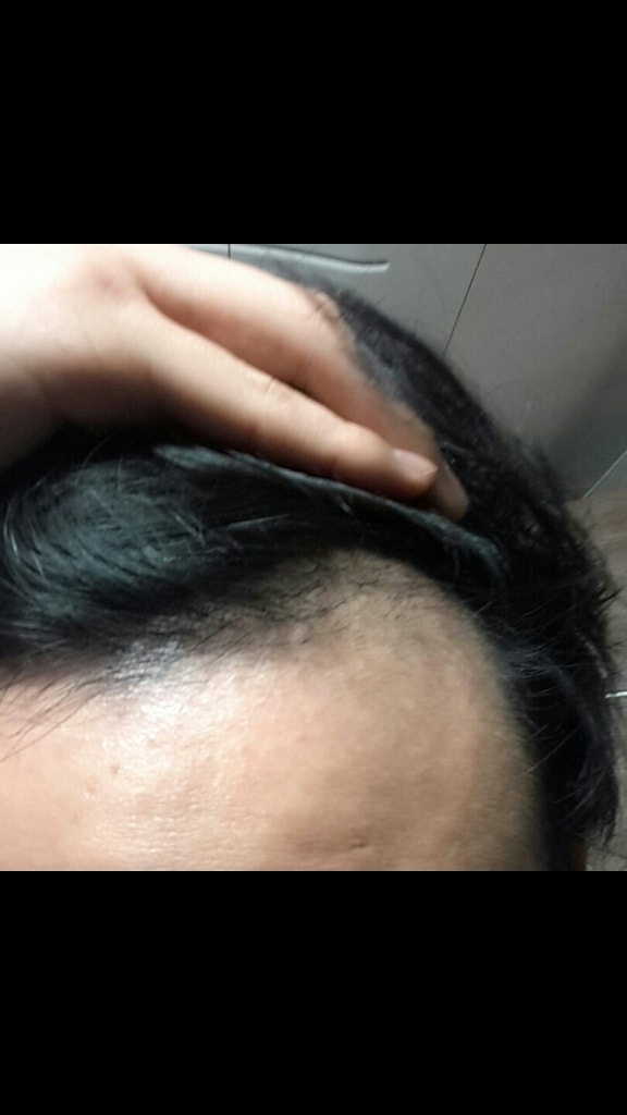 忠北大学处方第2、3个月的区分照片……