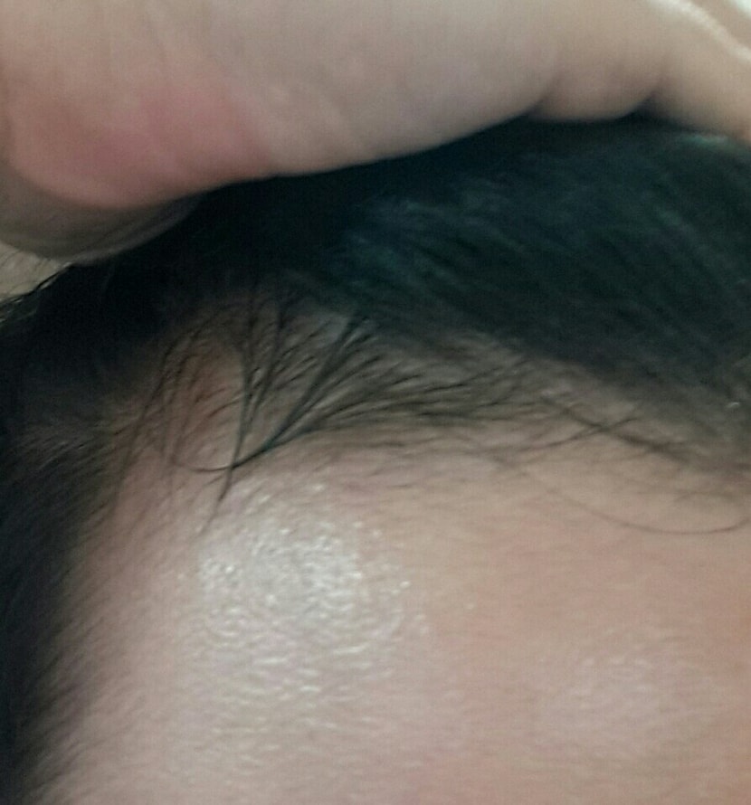 왼쪽  (기름진건 약 발라놔서 그렇습니다)