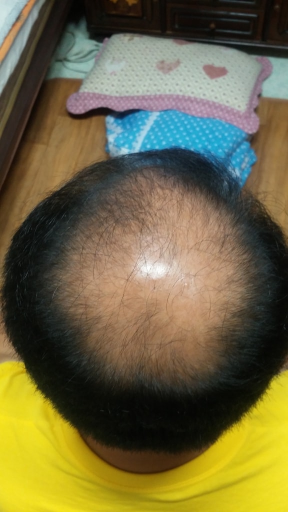 프카 신입생 입니다.