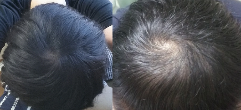 [photto] 专业色彩 1年6个月后期