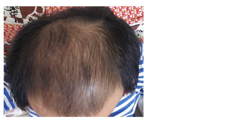 忠北大学的处方...6个月后期