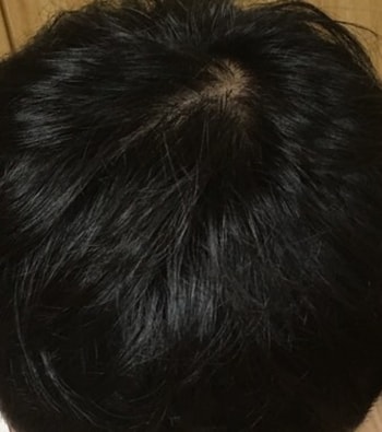 1년후