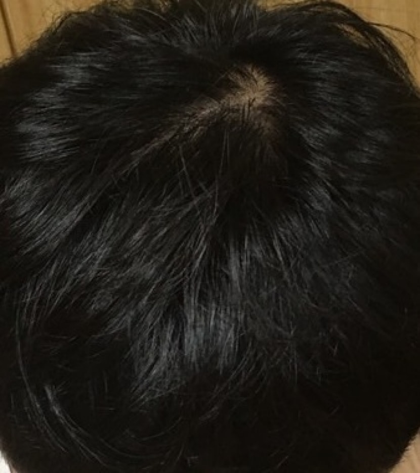 1년후