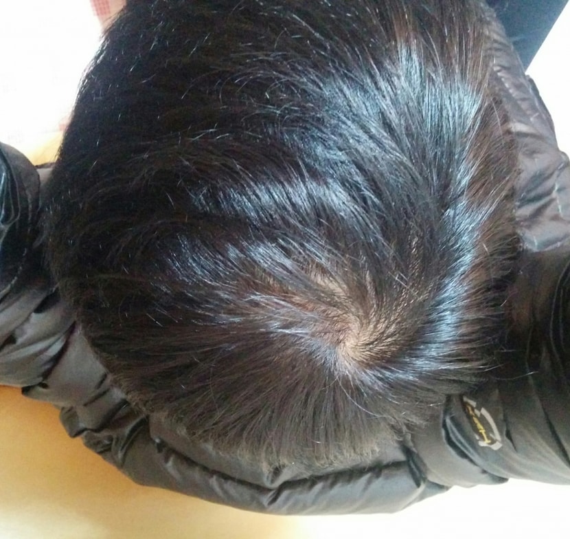 10개월후