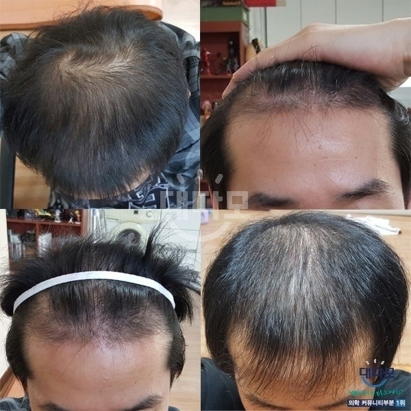 I am delivering my dreams and hopes to Daemo who stopped by for the first time in a long time.