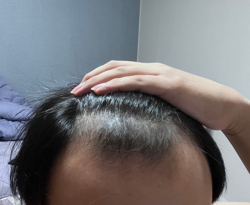 현재 머리 상태입니다.