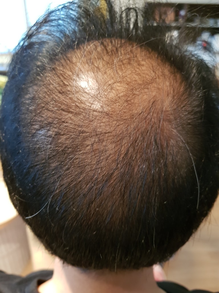 13개월 사용후