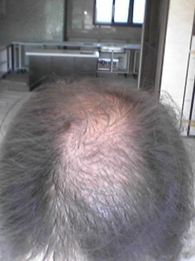 9월말부터 12월중순까지 프페/프카/기타(선식,샴프,금연,운동) 후기