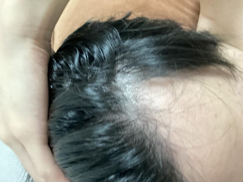 标志阴影应该会回来吧。