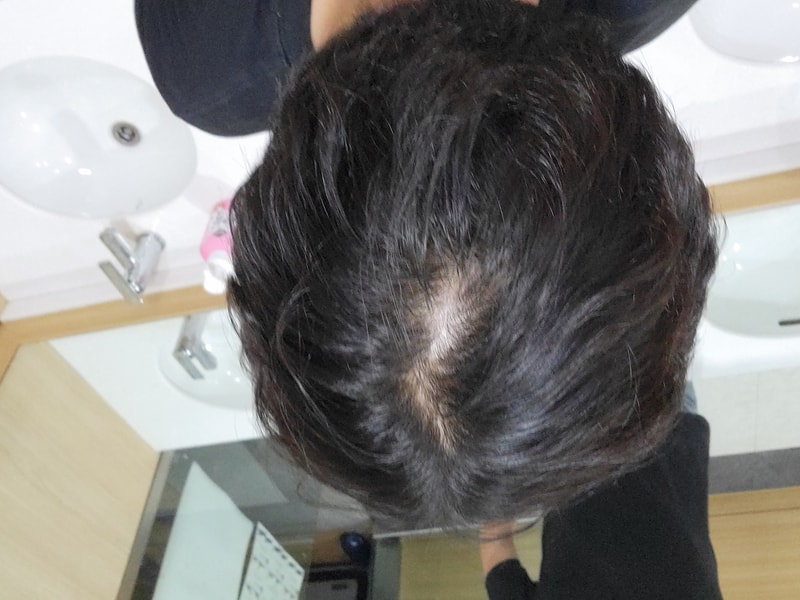 미노페시아 1달 복용