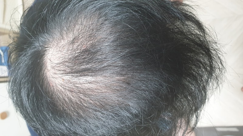 [For recording] 22.01.19 Start taking Damodat