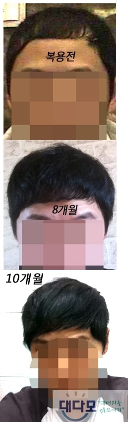 10개월