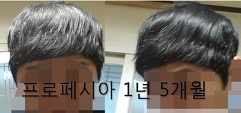 1년5개월