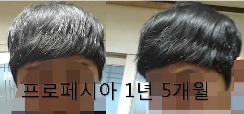 1년5개월