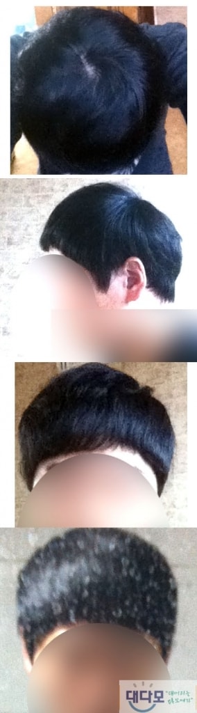 1년