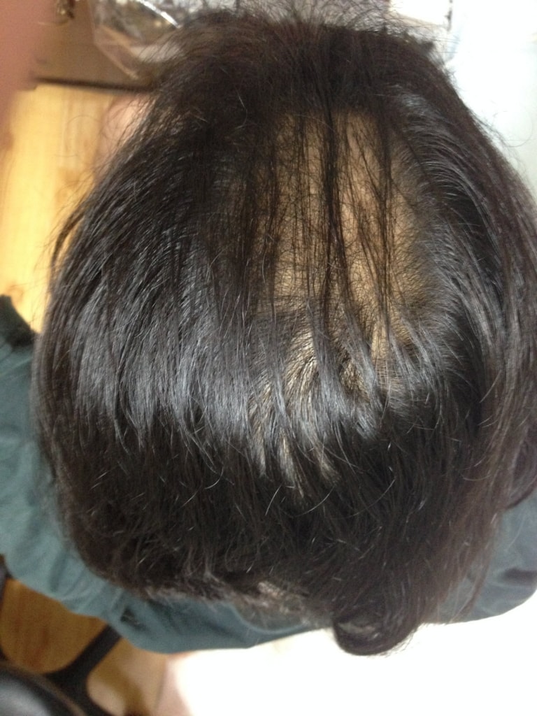 FFF7个月+FinFF1年+My Noxil1年7个月