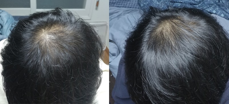 This is the third month of Monapesia.