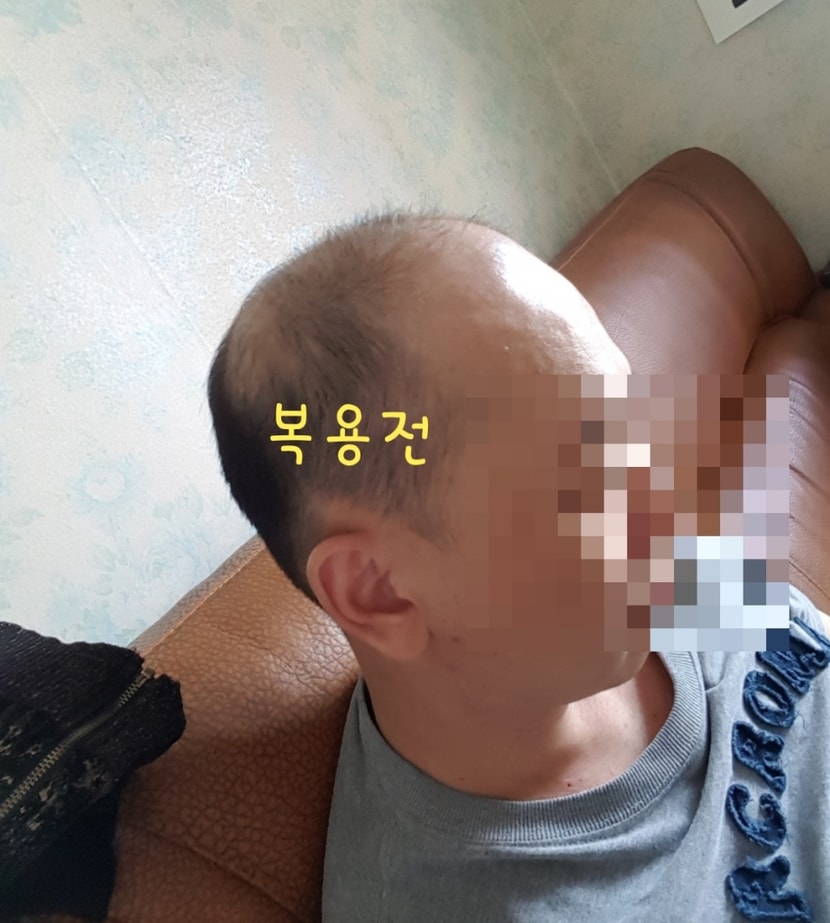 복용전
