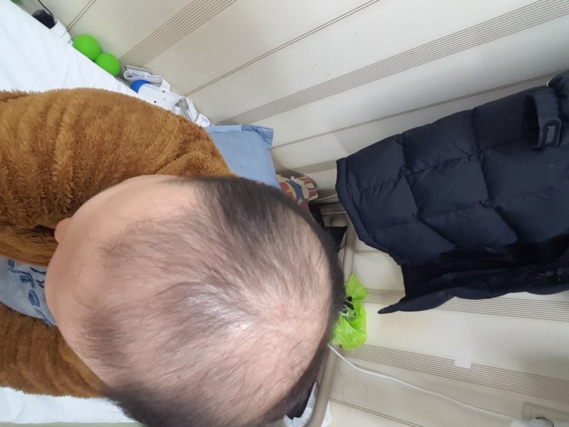 약복용후