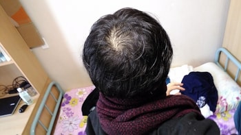 조금씩 효과를 보기 시작