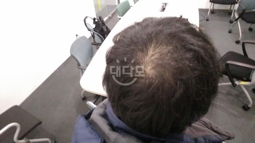 복용 두 달